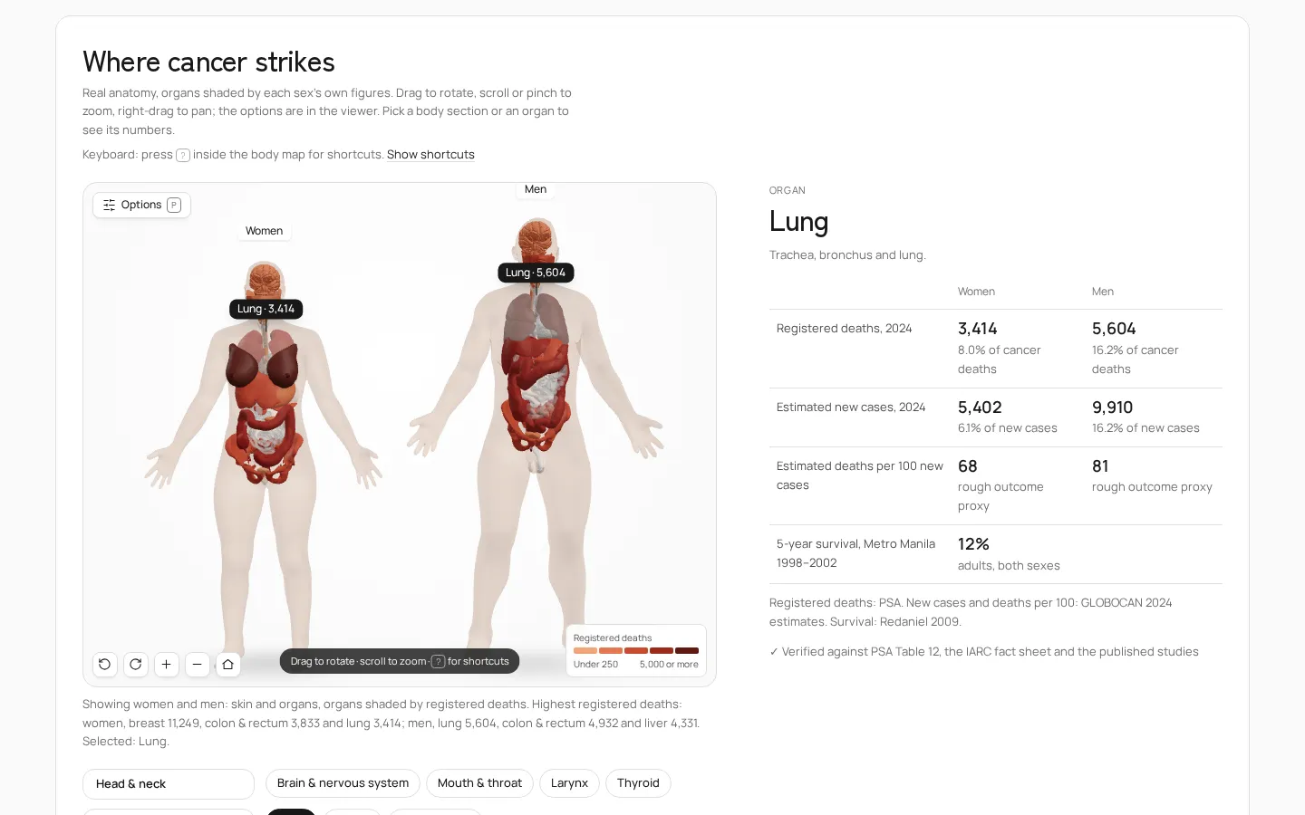 3D body map: organs shaded by each sex's registered deaths